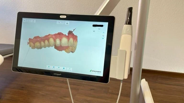 Intraoralscanner - Zahnarztpraxis Ettlingen